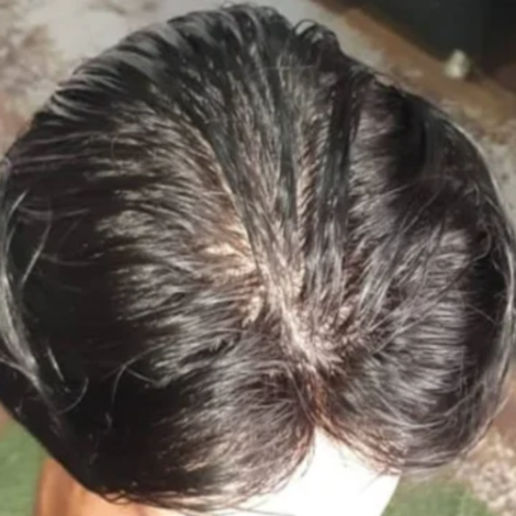 Mirage Hair Patch