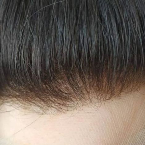 Full Lace Hair Patch