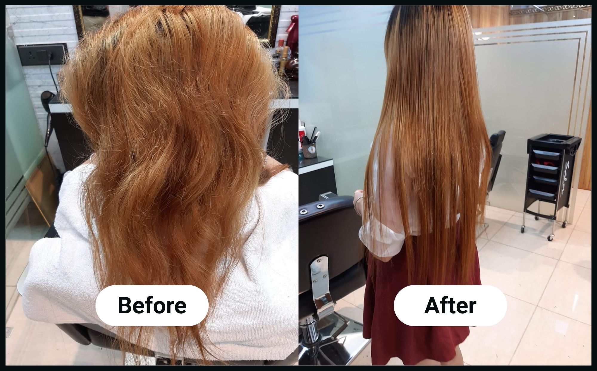 advance-hairline-image (1)